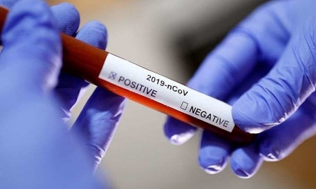 Brasil é o segundo país do mundo em mortes, mas apenas o 63º em testes para covid